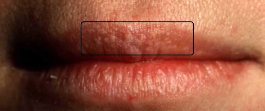 화면 캡처 2025-10-26 000032